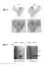 Fig. 05 - Methods for determining molecule folding associated with proteopathies