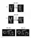 Fig. 07 - Methods for determining molecule folding associated with proteopathies