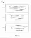 Fig. 02 - Methods and system for creating focal planes using an Alvarez lens