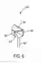 Fig. 08 - FIBER DROP TERMINAL