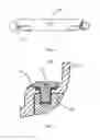 Fig. 03 - Watch Case