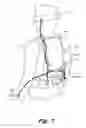 Fig. 08 - Wearable computing device mounts with stanchions