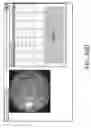 Fig. 49 - SYSTEMS AND METHODS FOR ENHANCEMENT OF RETINAL IMAGES