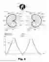 Fig. 09 - Binaural hearing systems and methods for preserving an interaural level difference between signals generated for each ear of a user