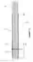 Fig. 03 - Tool handle and method of fabrication thereof