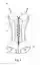 Fig. 02 - CORSET STRUCTURE