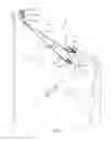 Fig. 04 - Garment Removal Apparatus and Method