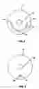 Fig. 04 - Medical device positioning system