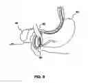 Fig. 08 - Medical device positioning system