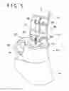Fig. 06 - Instrument insertion assisting tool