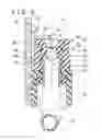 Fig. 07 - Instrument insertion assisting tool