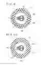 Fig. 09 - Instrument insertion assisting tool
