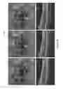 Fig. 09 - Systems and methods for automated segmentation of retinal fluid in optical coherence tomography