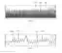 Fig. 06 - System and method for real-time heartbeat events detection using low-power motion sensor