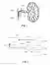 Fig. 02 - Systems and methods for treating cancer and/or augmenting organ function