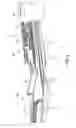 Fig. 04 - Surgical clip applier