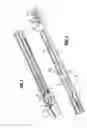 Fig. 07 - Endoscopic surgical clip applier