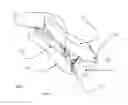 Fig. 02 - Cervical spinous process staple