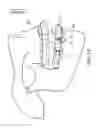 Fig. 02 - Orthodontic correction device