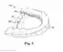 Fig. 08 - Arch expanding appliance