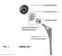 Fig. 02 - Medical implants having desired surface features and methods of manufacturing