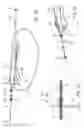 Fig. 03 - Stent delivery system