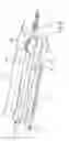 Fig. 05 - Stent delivery system