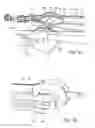 Fig. 07 - Stent delivery system