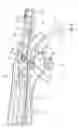 Fig. 10 - Stent delivery system
