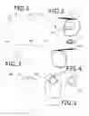 Fig. 02 - Back-up colostomy bag