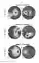 Fig. 08 - Chemotactic, drug-containing polymersomes