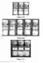 Fig. 15 - OPTIMIZED RATIOS OF AMINO ACIDS AND SUGARS AS AMORPHOUS STABILIZING COMPOUNDS IN PHARMACEUTICAL COMPOSITIONS CONTAINING HIGH CONCENTRATIONS OF PROTEIN-BASED THERAPEUTIC AGENTS
