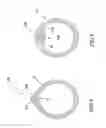 Fig. 09 - Guidable intravascular blood pump and related methods