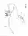 Fig. 05 - Closed suction cleaning devices, systems and methods