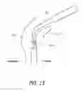 Fig. 22 - Closed suction cleaning devices, systems and methods