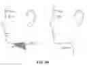 Fig. 85 - Systems, devices and methods for fractional resection, fractional skin grafting, fractional scar reduction and fractional tattoo removal