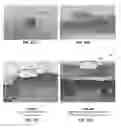 Fig. 09 - Treatment of tissue by the application of energy
