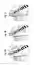 Fig. 06 - TRUCK WELL BARRIER SYSTEM