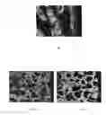 Fig. 02 - Method for producing porous calcium deficient hydroxyapatite granules