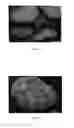 Fig. 03 - Method for producing porous calcium deficient hydroxyapatite granules