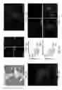 Fig. 02 - Methods and compositions for the prevention and treatment of surgical adhesions