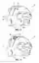 Fig. 04 - Athletic gear or other devices comprising post-molded expandable components