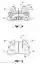 Fig. 10 - Athletic gear or other devices comprising post-molded expandable components