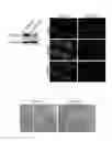 Fig. 06 - Method for promoting differentiation of pluripotent stem cells by reducing undifferentiated state thereof