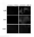 Fig. 09 - Method for promoting differentiation of pluripotent stem cells by reducing undifferentiated state thereof