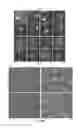 Fig. 22 - Methods for reactivating genes on the inactive X chromosome