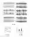 Fig. 35 - Methods for reactivating genes on the inactive X chromosome