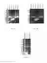 Fig. 05 - Double strand RNA-mediated RNA interference through feeding detrimental to larval (gypsy moth)