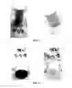 Fig. 04 - Galvanically-active in situ formed particles for controlled rate dissolving tools