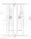 Fig. 07 - Hold open rod having an internal lock